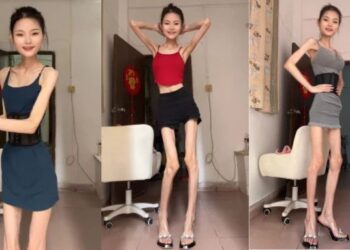 Chinese woman who weighs only 25kg still trying to lose weight